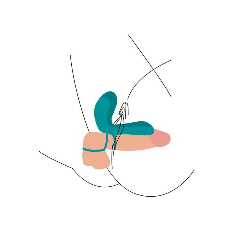 XOCOON - ANNEAU VIBRANT VERT POUR COUPLE